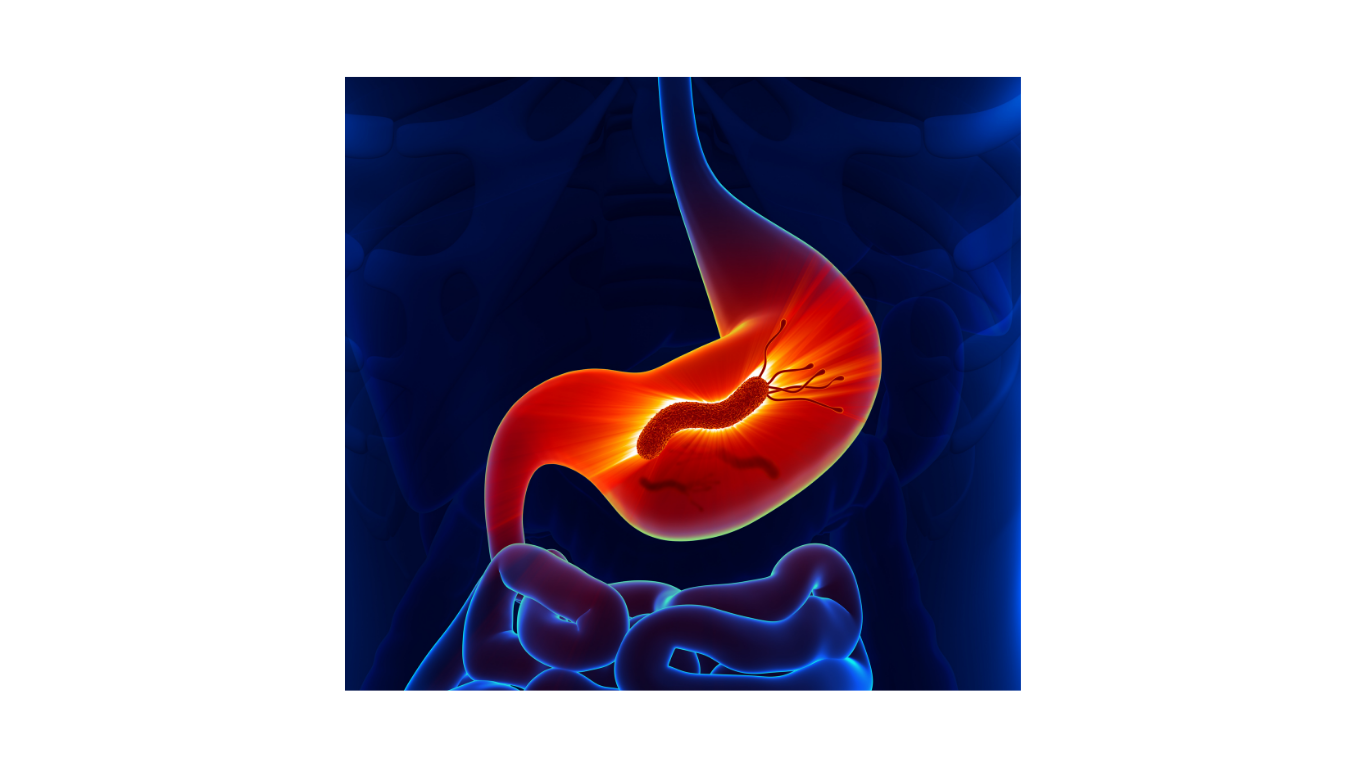 H. Pylori Antigen Test.